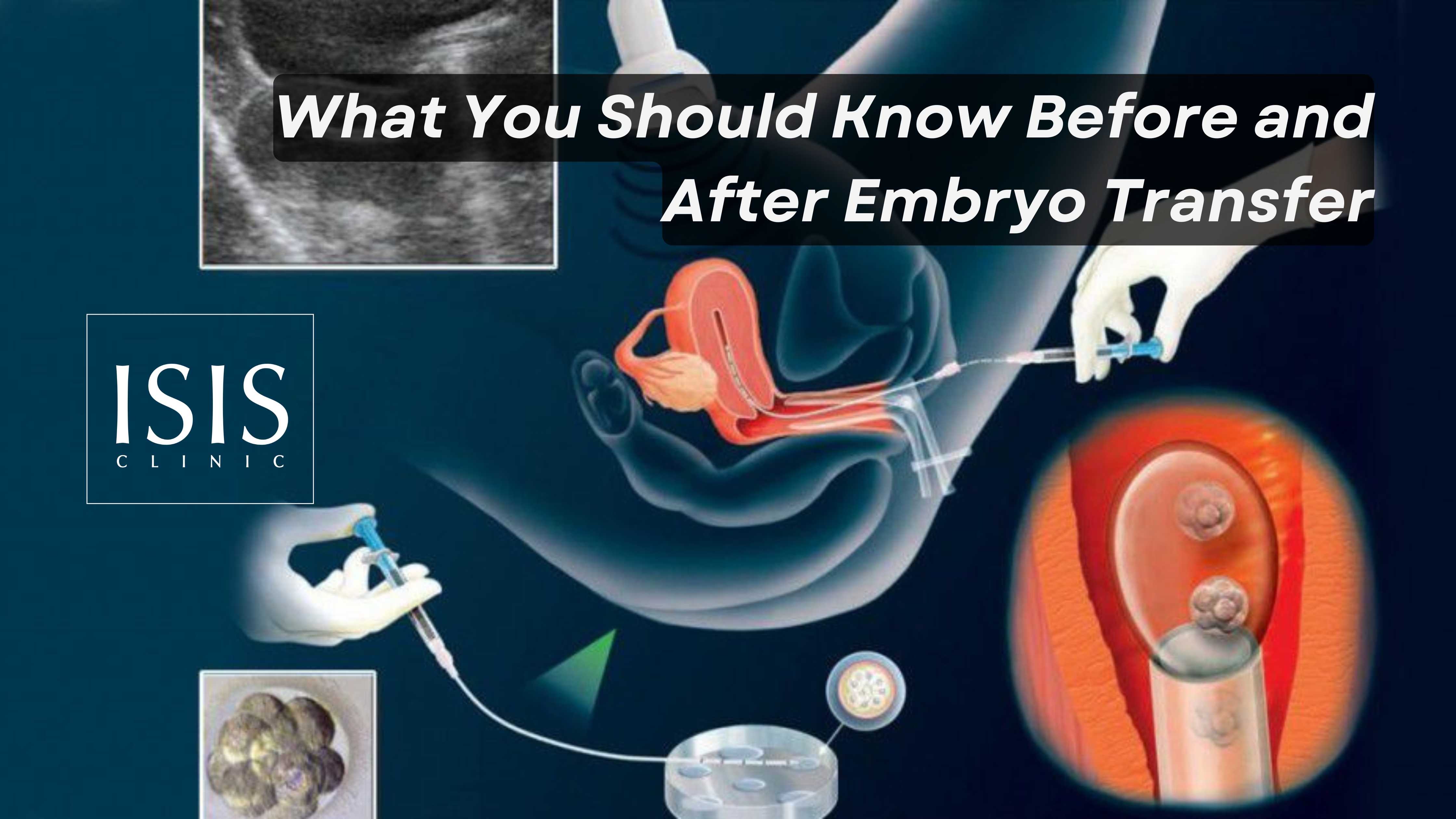 ivf-embryo-transfer-cyprus.jpg