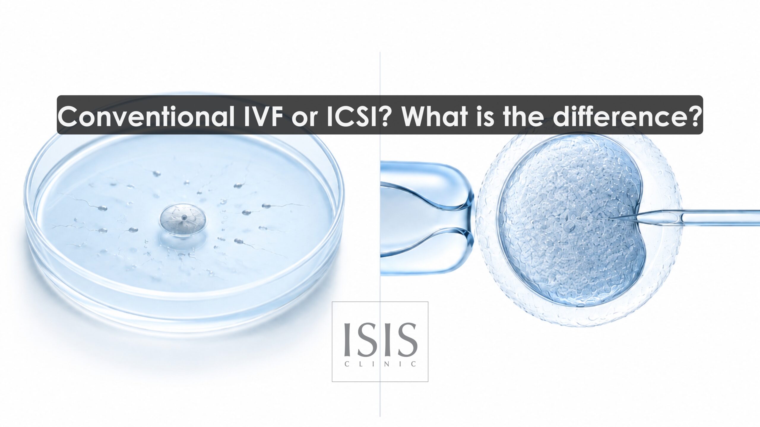 Conventional IVF or ICSI What is the difference